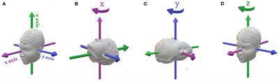 Vestibular Thresholds: A Review of Advances and Challenges in Clinical Applications